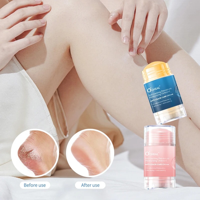 Anti Crack Foot Cream For Dry  - đánh giá và giá Heels